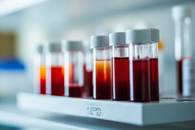 Rack of blood collection tubes on a laboratory bench